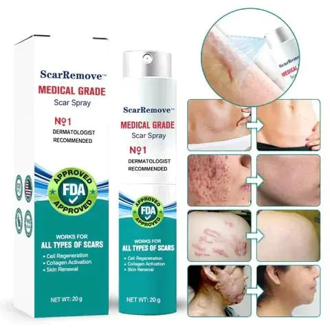 Advanced Scar Spray - Scar Removal