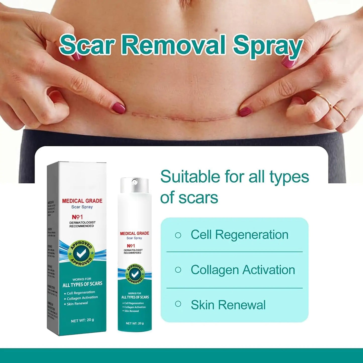 Advanced Scar Spray - Scar Removal